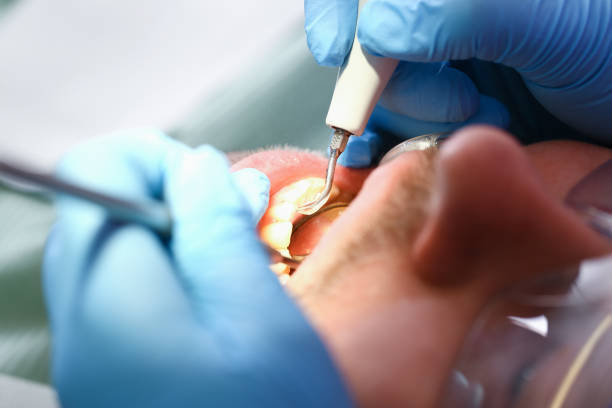 Best Emergency Orthodontic Repairs in Eulyptus Hills, CA