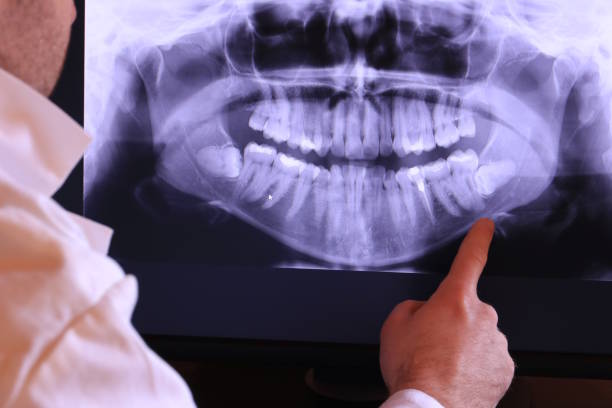 Best After-Hours Emergency Dentist in Eulyptus Hills, CA